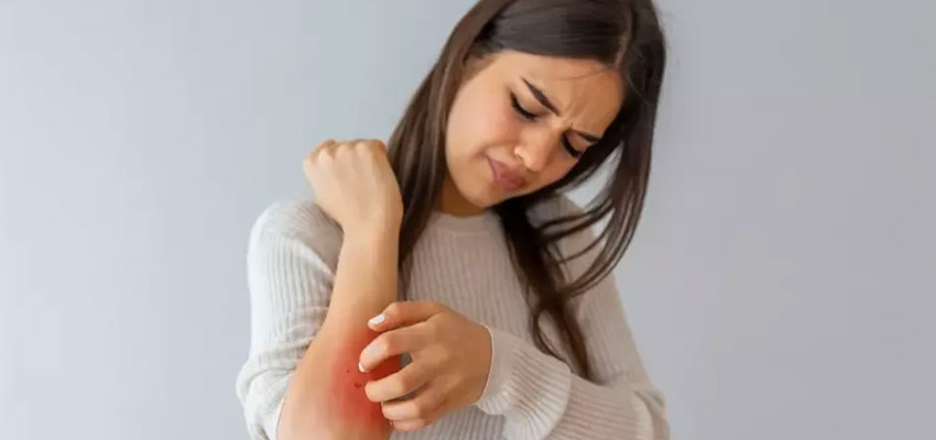 Effective Solutions for Skin Allergies: Top Medications and Treatments